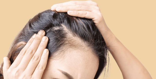 3 cách làm giảm rụng tóc tại nhà