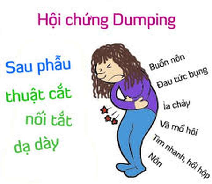 Điều trị Hội chứng Dumping dùng thuốc nào?